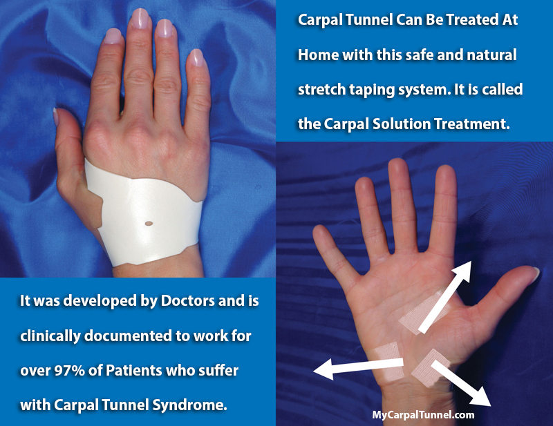 How to Diagnose Carpal Tunnel Syndrome - and the Best Treatment