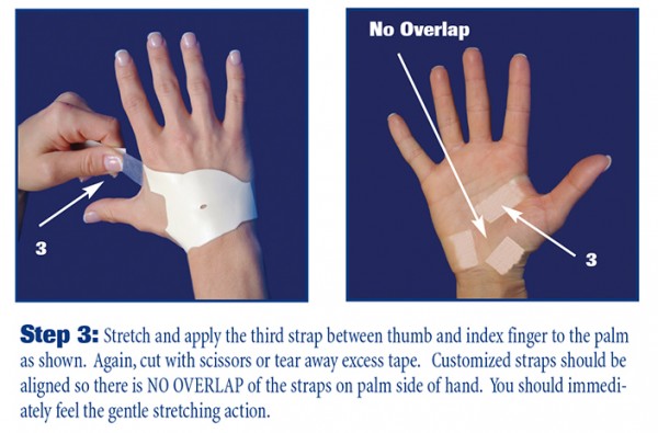 Carpal Tunnel Pain Worse After Carpal Tunnel Surgery? - The Carpal Solution