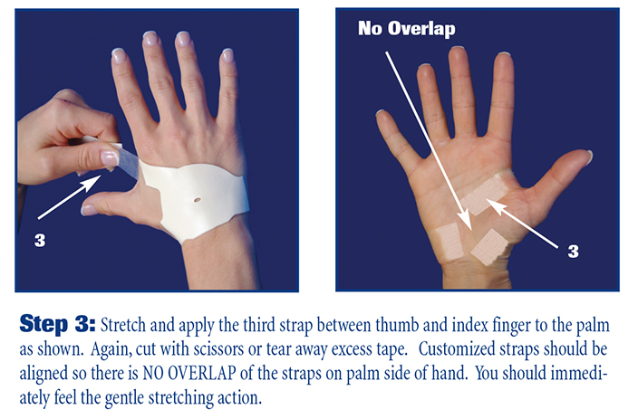 Carpal Tunnel Syndrome Exercises