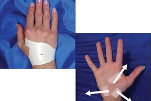 How Does The Carpal Tunnel Solution Work?