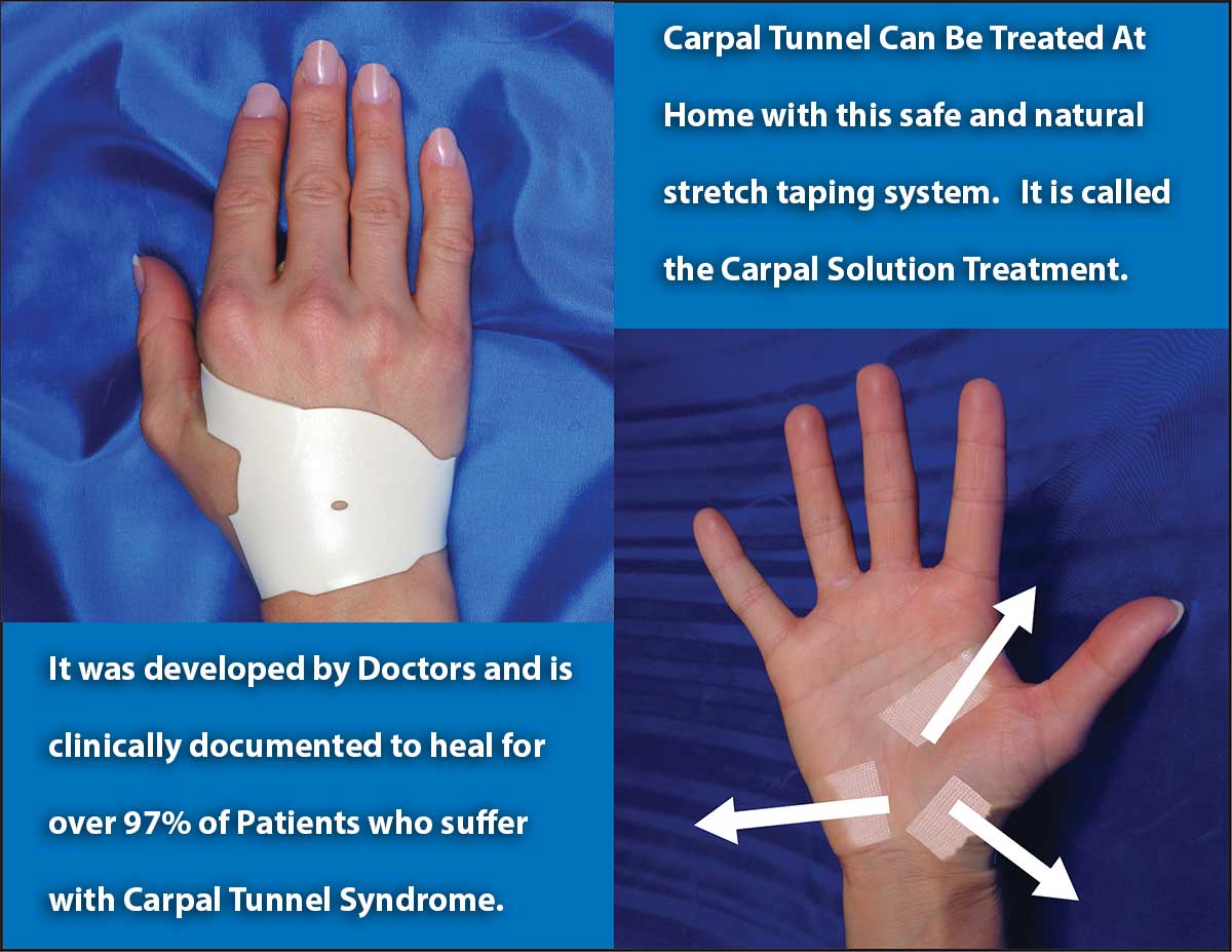 How To Heal Carpal Tunnel Syndrome The Carpal Solution