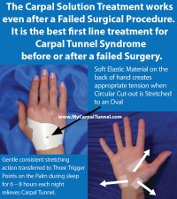 Carpal Tunnel Pain Worse After Carpal Tunnel Surgery? - The Carpal Solution