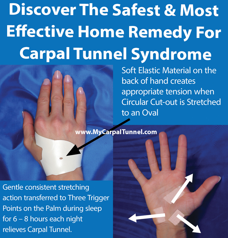 What is the Best Treatment for Carpal Tunnel Pain?