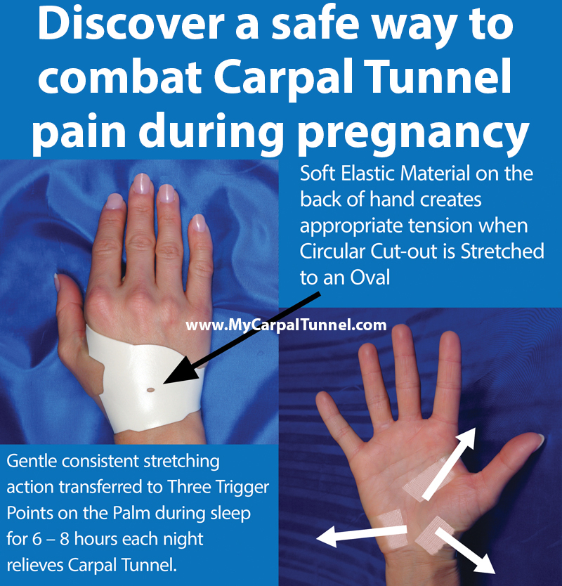 Pregnant Woman Gets Sleep Relieves Dull Ache Carpal Tunnel