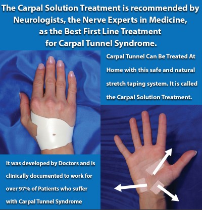 carpal tunnel surgery recovery time