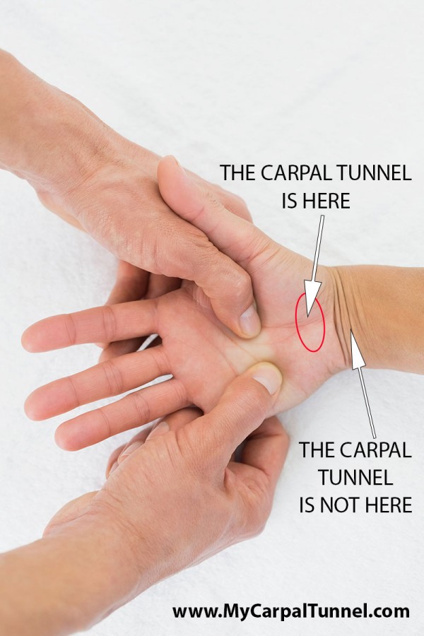 carpal-tunnel-syndrome-causes-treatment-splint-surgery