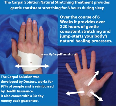 Falling Behind At Work Due to Carpal Tunnel Syndrome - The Carpal Solution