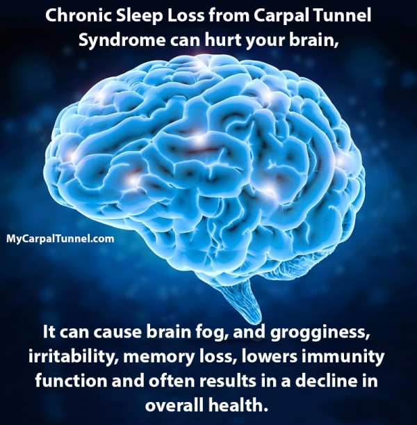 Can Sleep Loss From Carpal Tunnel Affect The Brain? - The Carpal Solution