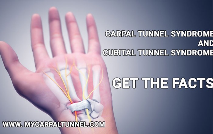 Carpal Tunnel Facts | The Carpal Solution