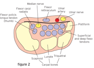 Endoscopic Carpal Tunnel Surgery