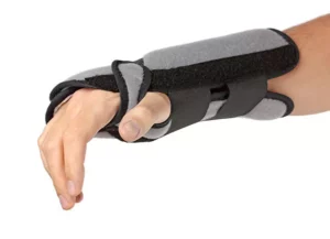 Cock-up Splints for Carpal Tunnel Syndrome