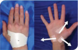 How To Apply The Carpal Solution