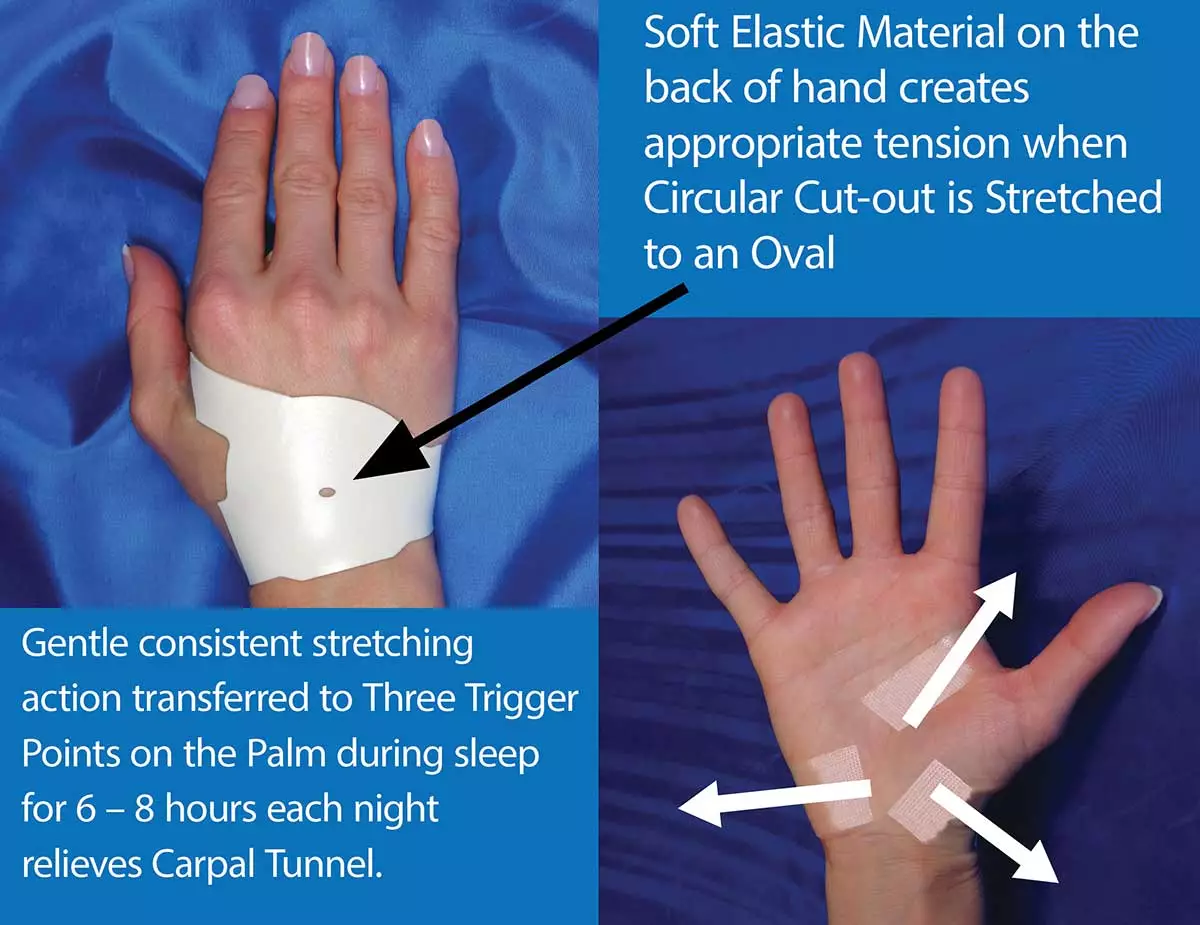 The Carpal Solution provides over 224 hours of targeted gentle stretching developed by Doctors. There is no other way to duplicate this type of consistent gentle stretching therapy in such a short period of time. 