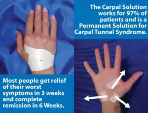 The Carpal Solution