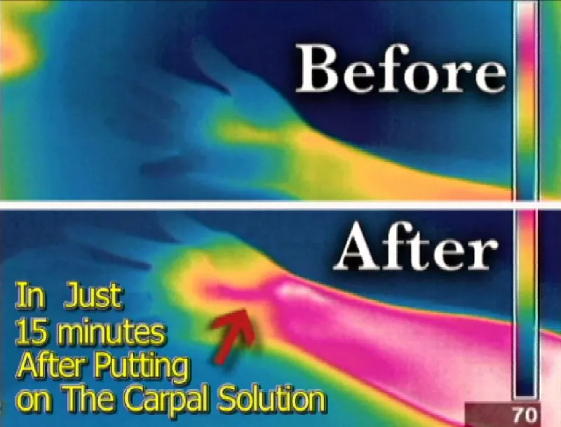 See how The Carpal Solution works to increase blood circulation. 