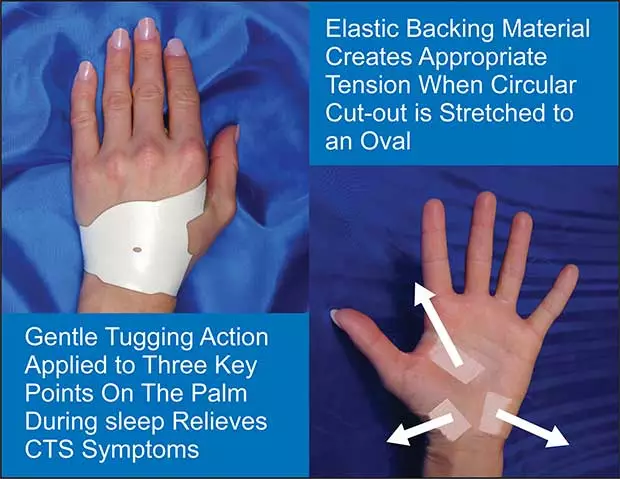 How does The Carpal Solution work? 